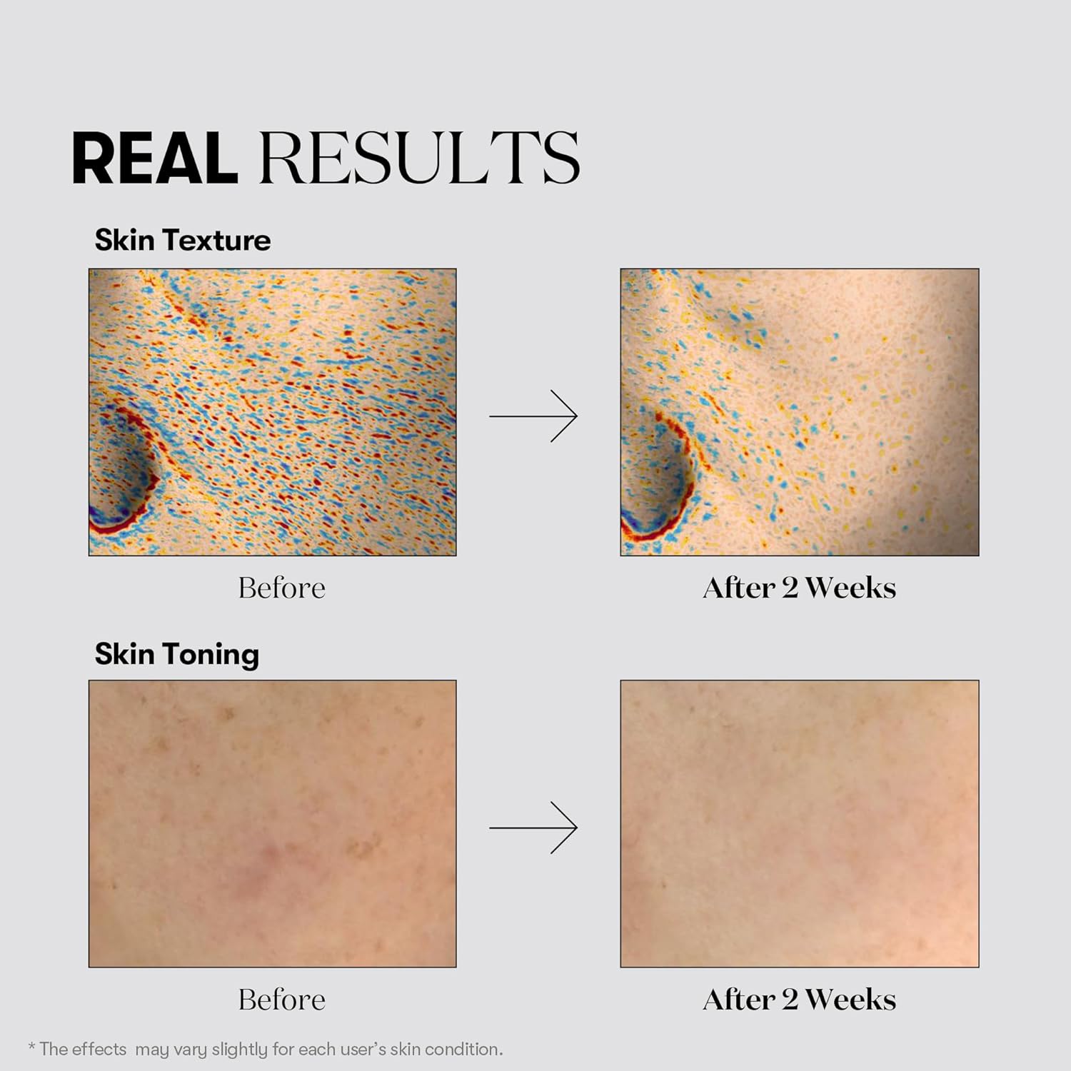 Balinošs krēms ar traneksāmskābi VT Cosmetics TX-Toning Cream
