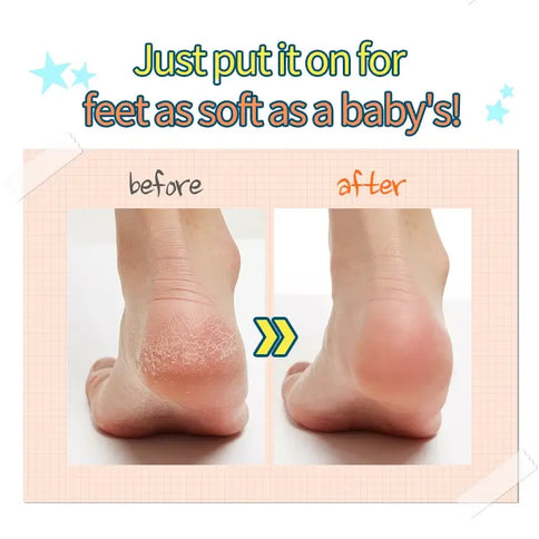 Pīlings-zeķes A'pieu Soft Foot Peeling Socks  A'pieu   