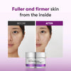 Liftingu kreem mikronõeltega VT Cosmetics Reedle Shot Lifting Cream