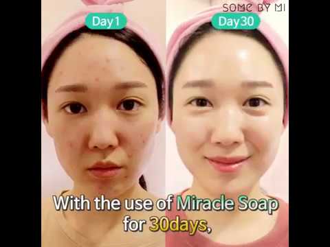 Attīrošas ziepes ar skābēm problemātiskai ādai Some By Mi AHA-BHA-PHA 30 Days Miracle Cleansing Bar  Some By Mi   